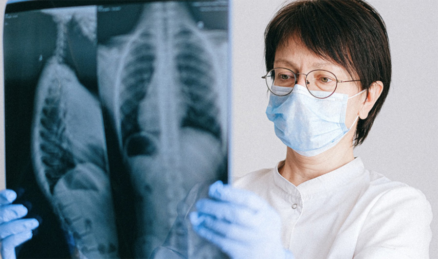 2022年新的肺癌治疗方法