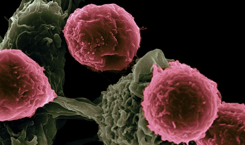 dostarlimab 可用于治疗哪些类型的癌症？您需要的唯一概述。